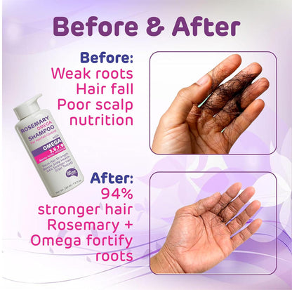 Korean Hair Essence Rosemary Shampoo for Hair Fall Control | Enriched with Hibiscus, Omega 3,6,7,9 & Amino Acids | Strengthens Roots, Boosts Scalp Health & Reduces Breakage | Sulphate & Paraben Free Gentle Cleanser | 225ml